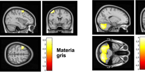 Un estudio revela que crecer en vecindarios verdes beneficia el desarrollo del cerebro